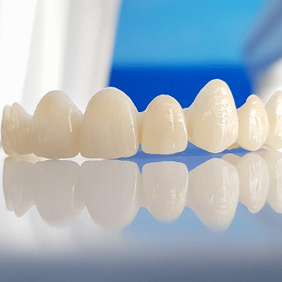 Dental Crown in Islamabad | Dental Crown Bridge